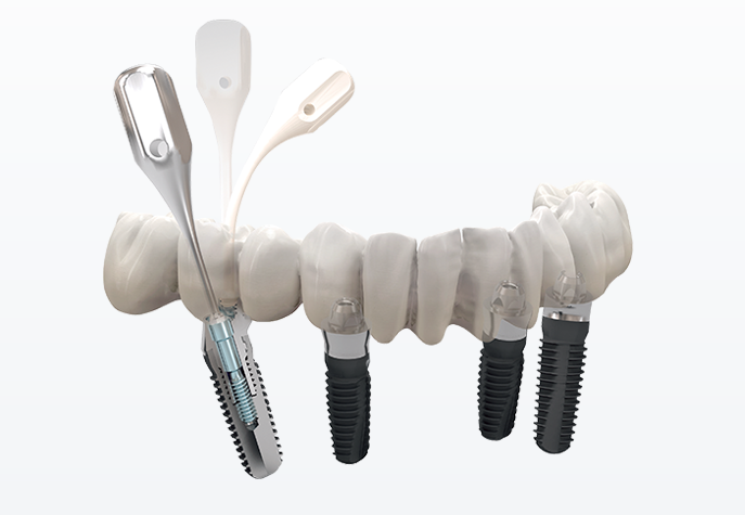 种植体附件Accessories for Dental Implants