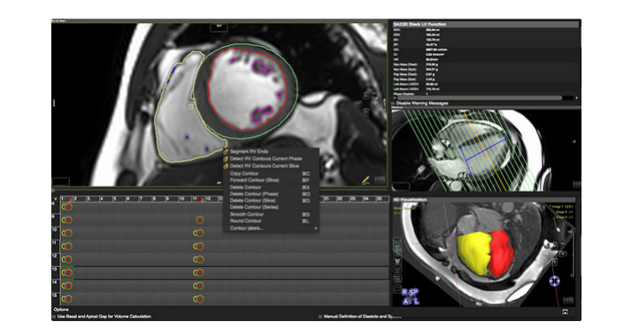 心血管图像处理软件Cardiovascular image processing software