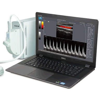 超声诊断系统Ultrasound System