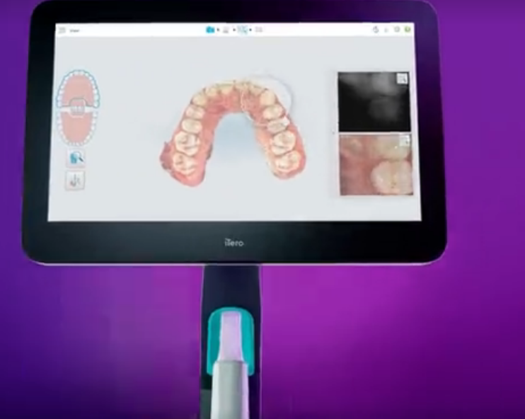 口腔数字印模仪Dental Imaging System