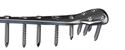 金属锁定接骨板系统APS Metal Plate & Screw  System