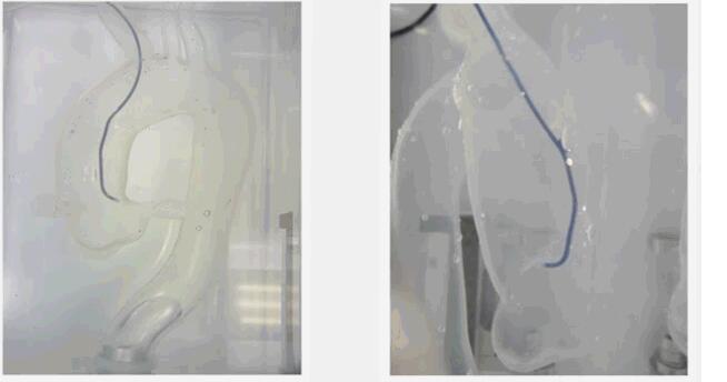 血管造影导管DxTerity Diagnostic Catheter