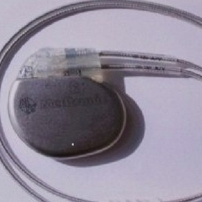 植入式心脏起搏器Implantable Pacemaker